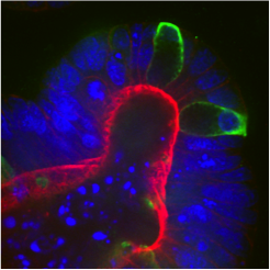 epithelial cell